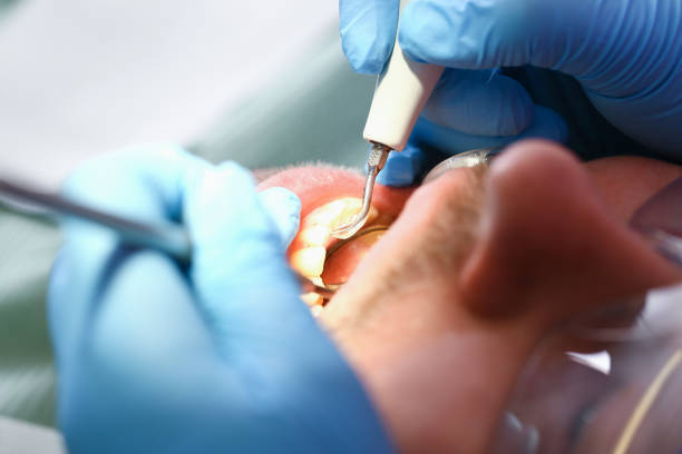 Best Emergency Root Canal Treatment in Nd Point, WI