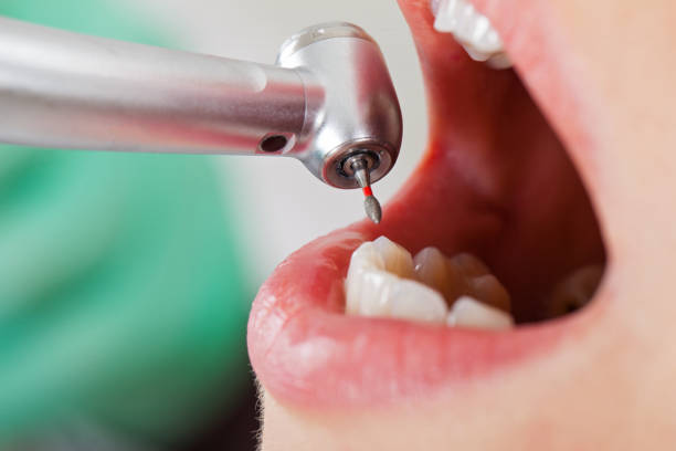 Best Emergency Tooth Extraction in Nd Point, WI